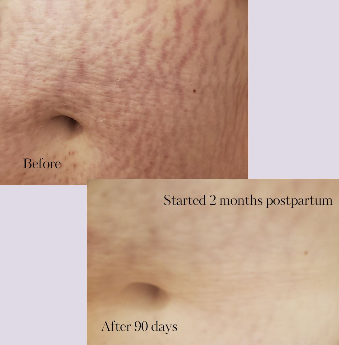 Revitalize Postpartum Cream 4oz
