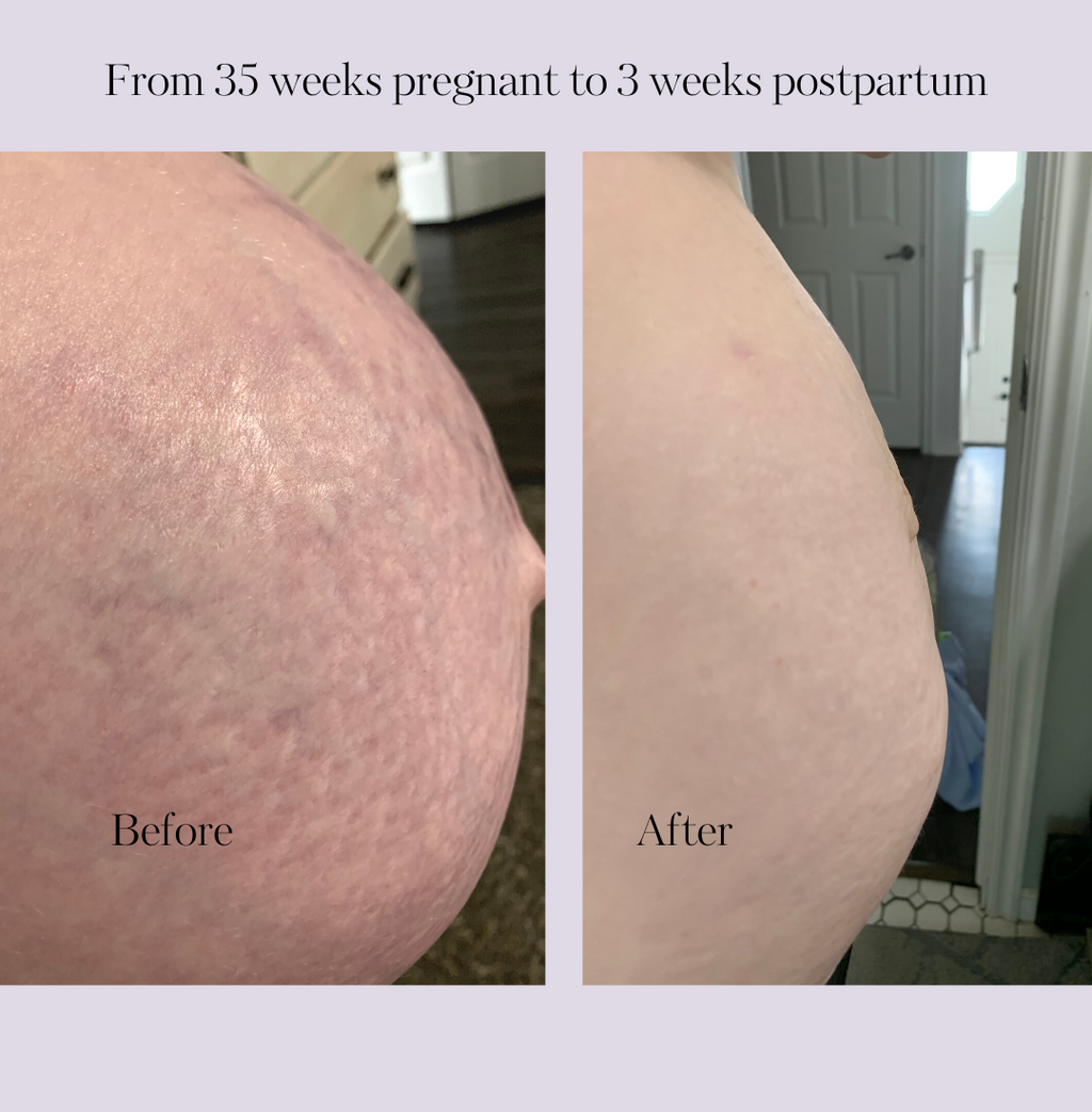 Revitalize Postpartum Cream 4oz