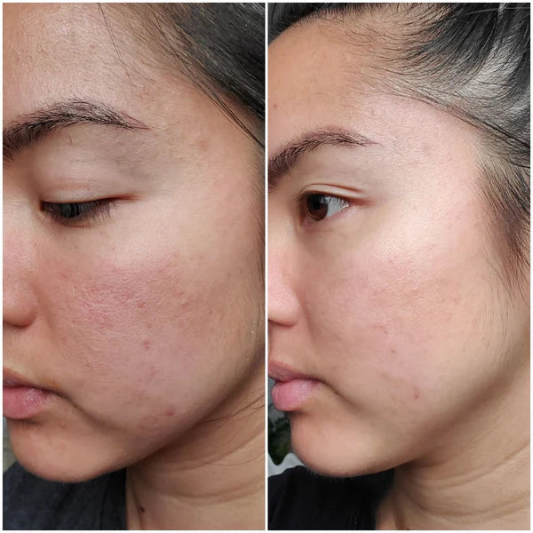 It Girl Skin – Skin Food